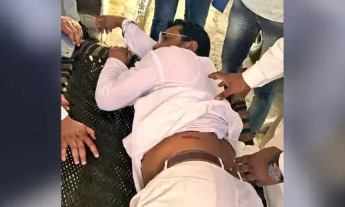 ಭೀಮ್ ಆರ್ಮಿ ಮುಖ್ಯಸ್ಥ ಚಂದ್ರಶೇಖರ್ ಆಝಾದ್ ಮೇಲೆ ಗುಂಡಿನ ದಾಳಿ, ಆಸ್ಪತ್ರೆಗೆ ದಾಖಲು