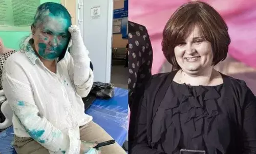 ರಶ್ಯ: ತನಿಖಾ ಪತ್ರಕರ್ತರ ತಲೆ ಬೋಳಿಸಿ ಚಿತ್ರಹಿಂಸೆ