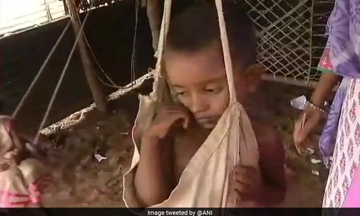 ಮಧ್ಯಪ್ರದೇಶದಲ್ಲಿ ಕಳೆದ ಮೂರು ತಿಂಗಳಲ್ಲಿ ಸುಮಾರು 78,000 ಮಕ್ಕಳಲ್ಲಿ ಅಪೌಷ್ಟಿಕತೆ: ಅಂಕಿ-ಅಂಶ ಮುಂದಿಟ್ಟ ಸಿಎಂ ಚೌಹಾಣ್