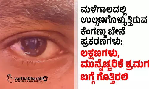 ಮಳೆಗಾಲದಲ್ಲಿ ಉಲ್ಬಣಗೊಳ್ಳುತ್ತಿರುವ ಕೆಂಗಣ್ಣು ಬೇನೆ ಪ್ರಕರಣಗಳು; ಲಕ್ಷಣಗಳು, ಮುನ್ನೆಚ್ಚರಿಕೆ ಕ್ರಮಗಳ ಬಗ್ಗೆ ಗೊತ್ತಿರಲಿ