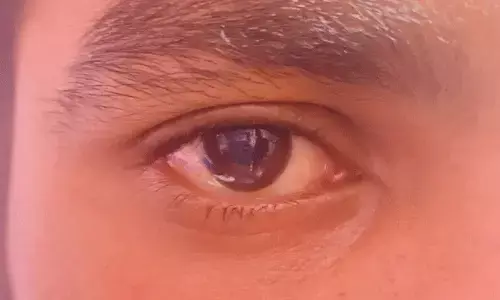 ಕೆಂಗಣ್ಣಿನಿಂದ ದೂರ ಇರಿ: ನೇತ್ರ ಆರೋಗ್ಯಕ್ಕೆ ಏಳು ಸರಳ ಸೂತ್ರಗಳು