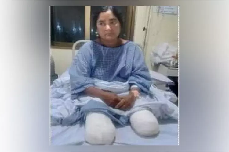 ಡಿಐಜಿ ಪತ್ನಿಯಿಂದ ಚಿತ್ರಹಿಂಸೆ ಆರೋಪ: ಆತ್ಮಹತ್ಯೆಗೆ ಯತ್ನಿಸಿ ಎರಡೂ ಕಾಲು ಕಳೆದುಕೊಂಡ ಮಹಿಳಾ ಹೋಮ್ ಗಾರ್ಡ್ ಡಿಐಜಿ ಪತ್ನಿಯಿಂದ ಚಿತ್ರಹಿಂಸೆ ಆರೋಪ: ಆತ್ಮಹತ್ಯೆಗೆ ಯತ್ನಿಸಿ ಎರಡೂ ಕಾಲು ಕಳೆದುಕೊಂಡ ಮಹಿಳಾ ಹೋಮ್ ಗಾರ್ಡ್