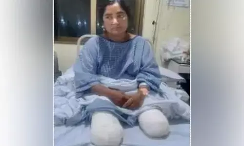 ಡಿಐಜಿ ಪತ್ನಿಯಿಂದ ಚಿತ್ರಹಿಂಸೆ ಆರೋಪ: ಆತ್ಮಹತ್ಯೆಗೆ ಯತ್ನಿಸಿ ಎರಡೂ ಕಾಲು ಕಳೆದುಕೊಂಡ ಮಹಿಳಾ ಹೋಮ್ ಗಾರ್ಡ್