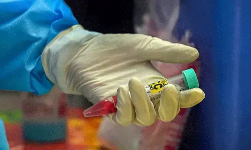 ಇಬ್ಬರು ಆಟಗಾರರಿಗೆ ಕೋವಿಡ್ ಸೋಂಕು ದೃಢ; ಏಶ್ಯಕಪ್ ಗೂ ಮುನ್ನ ಶ್ರೀಲಂಕಾ ಕ್ರಿಕೆಟ್ ತಂಡಕ್ಕೆ ತೀವ್ರ ಹಿನ್ನಡೆ