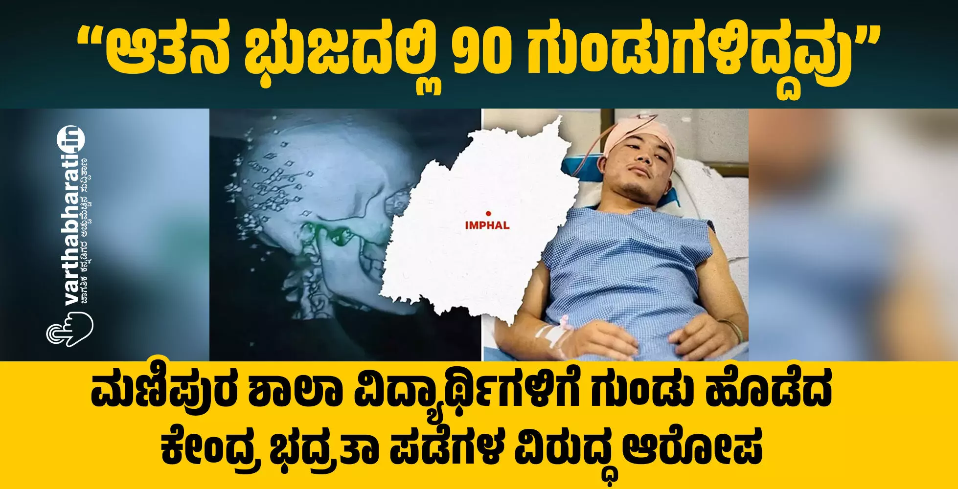 “ಆತನ ಭುಜದಲ್ಲಿ 90 ಗುಂಡುಗಳಿದ್ದವು” “ಆತನ ಭುಜದಲ್ಲಿ 90 ಗುಂಡುಗಳಿದ್ದವು”