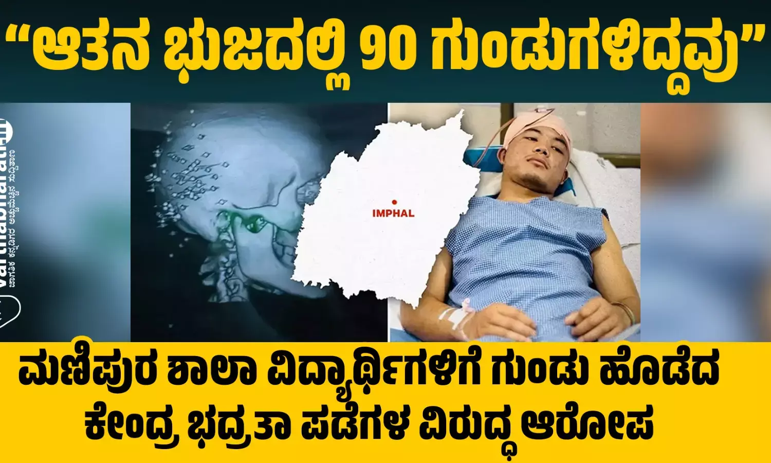 “ಆತನ ಭುಜದಲ್ಲಿ 90 ಗುಂಡುಗಳಿದ್ದವು”