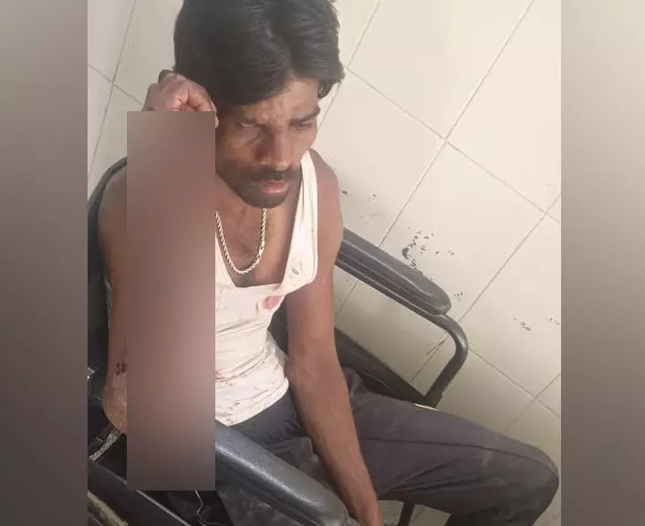 ದಲಿತ ಯುವಕನಿಗೆ ಮರಕ್ಕೆ ಕಟ್ಟಿಹಾಕಿ ಹಲ್ಲೆ; ಪ್ರಕರಣ ದಾಖಲು