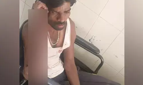 ದಲಿತ ಯುವಕನಿಗೆ ಮರಕ್ಕೆ ಕಟ್ಟಿಹಾಕಿ ಹಲ್ಲೆ; ಪ್ರಕರಣ ದಾಖಲು