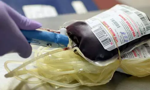 ಉತ್ತರ ಪ್ರದೇಶ ಆಸ್ಪತ್ರೆಯಲ್ಲಿ ರಕ್ತ ಪೂರಣ: 14 ಮಕ್ಕಳಿಗೆ ಕಾಮಾಲೆ ಮತ್ತು ಎಚ್‍ಐವಿ ಸೋಂಕು