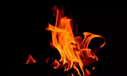 ಬೆಂಗಳೂರಿನಲ್ಲಿ ಮತ್ತೊಂದು ಅಗ್ನಿ ಅವಘಡ; ಕಾರ್ಖಾನೆಯೊಂದರ ತ್ಯಾಜ್ಯಕ್ಕೆ ಆಕಸ್ಮಿಕ ಬೆಂಕಿ