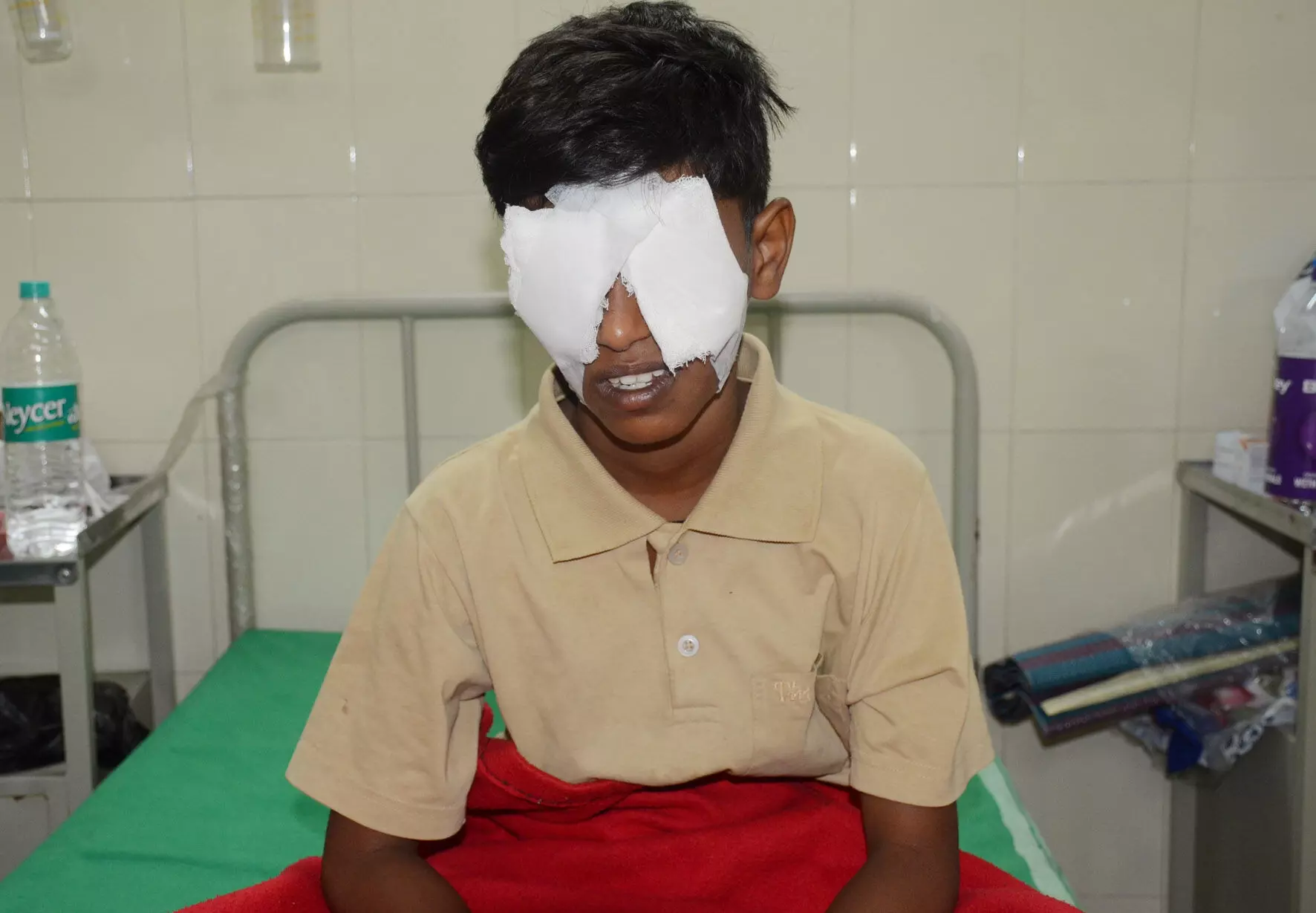 ಬೆಂಗಳೂರು: ಪಟಾಕಿ ಸಿಡಿದು 60 ಕ್ಕೂ ಹೆಚ್ಚು ಮಂದಿಯ ಕಣ್ಣಿಗೆ ಗಾಯ