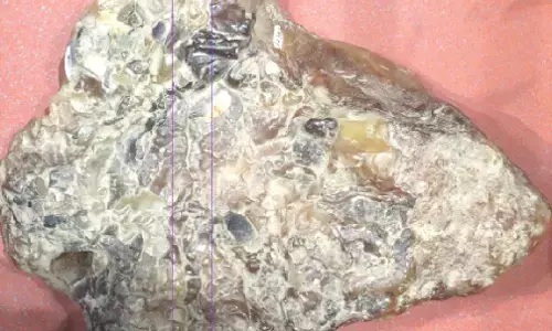 ತಿಮಿಂಗಿಲ ವಾಂತಿಗೆ ಭಾರೀ ಬೇಡಿಕೆ