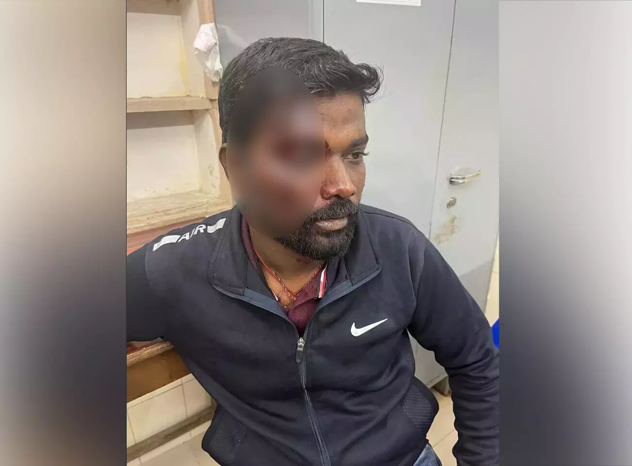 ಭದ್ರಾವತಿ: ಶಾಸಕರ ವಿರುದ್ಧ ಸಾಮಾಜಿಕ ಜಾಲತಾಣದಲ್ಲಿ ಪೋಸ್ಟ್ ಮಾಡಿದ ಬಿಜೆಪಿ ಕಾರ್ಯಕರ್ತನಿಗೆ ಹಲ್ಲೆ