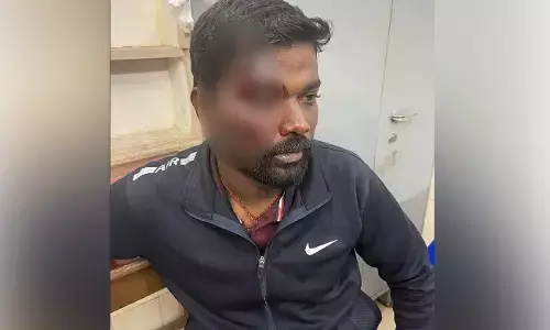 ಭದ್ರಾವತಿ: ಶಾಸಕರ ವಿರುದ್ಧ ಸಾಮಾಜಿಕ ಜಾಲತಾಣದಲ್ಲಿ ಪೋಸ್ಟ್ ಮಾಡಿದ ಬಿಜೆಪಿ ಕಾರ್ಯಕರ್ತನಿಗೆ ಹಲ್ಲೆ