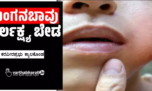 ಮಂಗನಬಾವು: ನಿರ್ಲಕ್ಷ್ಯ ಬೇಡ