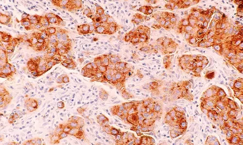 ವಂಶಾವಳಿ ಔಷಧದಿಂದ ಕ್ಯಾನ್ಸರ್ ಆರೈಕೆಯತ್ತ ಕ್ರಾಂತಿಕಾರಕ ಹೆಜ್ಜೆ