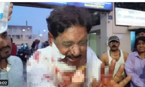 ಬಿಹಾರ: ಪತ್ರಕರ್ತನ ಮೇಲೆ ಗುಂಡಿನ ದಾಳಿ ನಡೆಸಿದ ದುಷ್ಕರ್ಮಿಗಳು