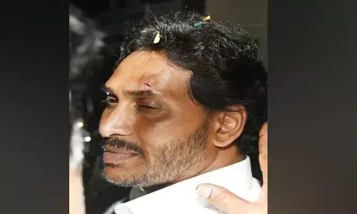 ರೋಡ್ ಶೋ ವೇಳೆ ಕಲ್ಲು ತೂರಾಟ: ಆಂಧ್ರ ಸಿಎಂ ಜಗನ್ ರೆಡ್ಡಿಗೆ ಗಾಯ