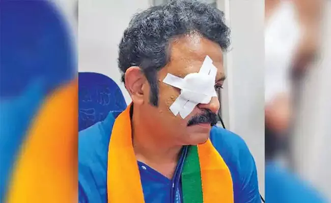 ಕೇರಳ | ಬಿಜೆಪಿ ಲೋಕಸಭಾ ಅಭ್ಯರ್ಥಿಯ ಮೇಲಿನ ದಾಳಿಯಲ್ಲಿ ಸ್ವಪಕ್ಷಿಯ ಮುಖಂಡನೇ ಆರೋಪಿ!