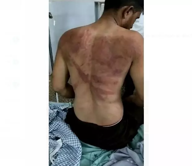 ವಿಜಯಪುರ: ದನಕರು ಸಾಗಾಟಗಾರನ ಮೇಲೆ ಬಜರಂಗ ದಳದಿಂದ ತೀವ್ರ ಹಲ್ಲೆ