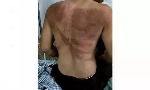 ವಿಜಯಪುರ: ದನಕರು ಸಾಗಾಟಗಾರನ ಮೇಲೆ ಬಜರಂಗ ದಳದಿಂದ ತೀವ್ರ ಹಲ್ಲೆ