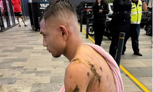 ಮಲೇಶ್ಯದ ರಾಷ್ಟ್ರೀಯ ಫುಟ್ಬಾಲ್ ಆಟಗಾರನ ಮೇಲೆ ಆ್ಯಸಿಡ್ ದಾಳಿ