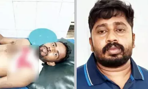 ಕುಮಟಾ | ಯುವಕನ ಕಣ್ಣಿಗೆ ಖಾರದ ಪುಡಿ ಎರಚಿ ಚೂರಿ ಇರಿತ: ಆರೋಪಿಯ ಸೆರೆ