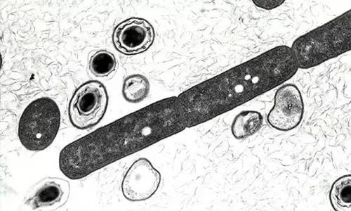 ಒಡಿಶಾ | ಮೂವರಲ್ಲಿ ಅಂಥ್ರಾಕ್ಸ್ ಸೋಂಕು ಪತ್ತೆ