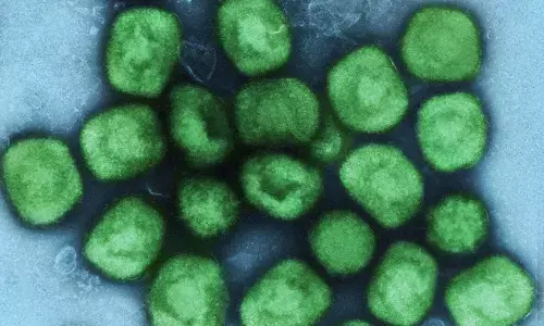 ದಕ್ಷಿಣ ಆಫ್ರಿಕಾದಲ್ಲಿ ಎಂಫಾಕ್ಸ್ ಸೋಂಕು ಉಲ್ಬಣ : ಒಬ್ಬ ಮೃತ್ಯು