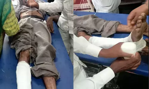 ಹಾಸನ | ಕಾಡಾನೆ ದಾಳಿಗೆ ವ್ಯಕ್ತಿಯ ಕಾಲು ಮುರಿತ