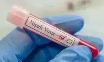 ಕೇರಳ | ನಿಫಾದಿಂದ ಮೃತಪಟ್ಟ ಬಾಲಕ, ಬಾವಲಿಗಳೇ ತುಂಬಿದ್ದ ಮರದಿಂದ ಹಣ್ಣು ಸೇವಿಸಿದ್ದ!