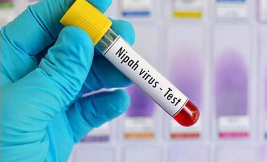 ಕೇರಳದಲ್ಲಿ ನಿಪಾ ವೈರಸ್ ಪತ್ತೆ : ಮಲಪ್ಪುರಂ ಜಿಲ್ಲೆಗೆ ಅನವಶ್ಯಕವಾಗಿ ಪ್ರಯಾಣ ಮಾಡದಂತೆ ಸೂಚನೆ ಕೇರಳದಲ್ಲಿ ನಿಪಾ ವೈರಸ್ ಪತ್ತೆ : ಮಲಪ್ಪುರಂ ಜಿಲ್ಲೆಗೆ ಅನವಶ್ಯಕವಾಗಿ ಪ್ರಯಾಣ ಮಾಡದಂತೆ ಸೂಚನೆ