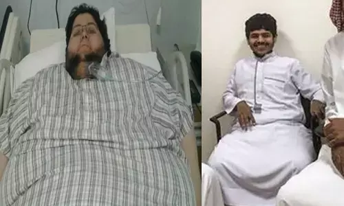 ನಂಬಲಸಾಧ್ಯ ರೀತಿಯಲ್ಲಿ 500 ಕೆಜಿ ತೂಕ ಕಳೆದುಕೊಂಡ ಸೌದಿ ವ್ಯಕ್ತಿ!