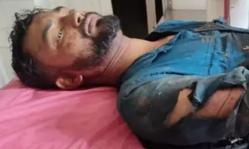 ಪುತ್ತೂರು | ದ್ವಿಚಕ್ರ ವಾಹನ ಸವಾರನ ಮೇಲೆ ಕಾಡುಹಂದಿ ದಾಳಿ: ಯುವಕಗೆ ತೀವ್ರ ಗಾಯ