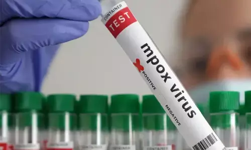 ಪಾಕಿಸ್ತಾನದ ಪೇಷಾವರದಲ್ಲಿ ಎಂಪಾಕ್ಸ್‌ 5ನೇ ಪ್ರಕರಣ ಪತ್ತೆ