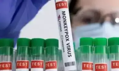 ಭಾರತದಲ್ಲಿ ಮೊದಲ ಶಂಕಿತ ಮಂಕಿಪಾಕ್ಸ್ ಪ್ರಕರಣ ವರದಿ