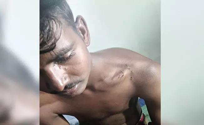 ಕೊಪ್ಪಳ | ಕಂಬಕ್ಕೆ ಕಟ್ಟಿ ಮಾದಿಗ ಯುವಕನಿಗೆ ಮಾರಣಾಂತಿಕ ಹಲ್ಲೆ ಆರೋಪ : ಪ್ರಕರಣ ದಾಖಲು ಕೊಪ್ಪಳ | ಕಂಬಕ್ಕೆ ಕಟ್ಟಿ ಮಾದಿಗ ಯುವಕನಿಗೆ ಮಾರಣಾಂತಿಕ ಹಲ್ಲೆ ಆರೋಪ : ಪ್ರಕರಣ ದಾಖಲು