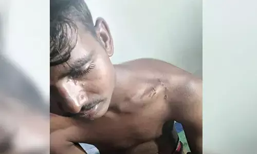 ಕೊಪ್ಪಳ | ಕಂಬಕ್ಕೆ ಕಟ್ಟಿ ಮಾದಿಗ ಯುವಕನಿಗೆ ಮಾರಣಾಂತಿಕ ಹಲ್ಲೆ ಆರೋಪ : ಪ್ರಕರಣ ದಾಖಲು