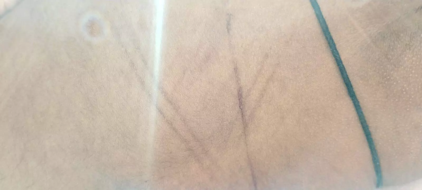 ಉಡುಪಿ | ಮೂರೂವರೆ ವರ್ಷದ ಮಗುವಿನ ಮೇಲೆ ತೀವ್ರ ಹಲ್ಲೆ: ಆಸ್ಪತ್ರೆಗೆ ದಾಖಲು