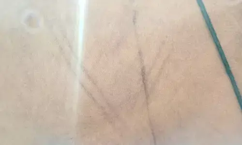 ಉಡುಪಿ | ಮೂರೂವರೆ ವರ್ಷದ ಮಗುವಿನ ಮೇಲೆ ತೀವ್ರ ಹಲ್ಲೆ: ಆಸ್ಪತ್ರೆಗೆ ದಾಖಲು