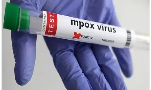 ಕೇರಳ | ಎಂಪಾಕ್ಸ್ ಸೋಂಕು ದೃಢ : ಆರೋಗ್ಯ ಇಲಾಖೆ