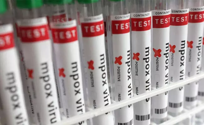 ಕೇರಳದಲ್ಲಿ ದಾಖಲಾದ ಎಂಪಾಕ್ಸ್ ಪ್ರಕರಣ ವೇಗವಾಗಿ ಹರಡುವ ಕ್ಲೇಡ್ 1 ಪ್ರಭೇದಕ್ಕೆ ಸೇರಿದ್ದು : ವರದಿ ಕೇರಳದಲ್ಲಿ ದಾಖಲಾದ ಎಂಪಾಕ್ಸ್ ಪ್ರಕರಣ ವೇಗವಾಗಿ ಹರಡುವ ಕ್ಲೇಡ್ 1 ಪ್ರಭೇದಕ್ಕೆ ಸೇರಿದ್ದು : ವರದಿ