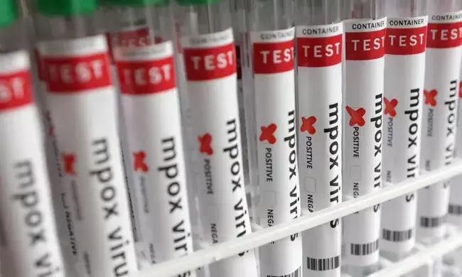 ಕೇರಳದಲ್ಲಿ ದಾಖಲಾದ ಎಂಪಾಕ್ಸ್ ಪ್ರಕರಣ ವೇಗವಾಗಿ ಹರಡುವ ಕ್ಲೇಡ್ 1 ಪ್ರಭೇದಕ್ಕೆ ಸೇರಿದ್ದು : ವರದಿ