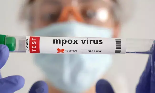 ಕೇರಳ | ಎರಡನೇ ಎಂಪಾಕ್ಸ್ ಪ್ರಕರಣ ಬೆಳಕಿಗೆ