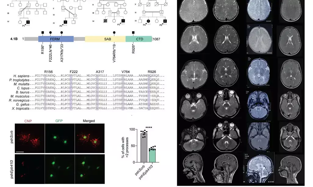 ಅನುವಂಶಿಕ ರೋಗಕ್ಕೆ ಜೀನ್‌ನ ನ್ಯೂನತೆಯನ್ನು ಪತ್ತೆ ಹಚ್ಚಿದ ಕೆಎಂಸಿಯ ಡಾ.ಅಂಜು ಶುಕ್ಲ ನೇತೃತ್ವದ ಅಂ.ರಾ.ವಿಜ್ಞಾನಿಗಳ ತಂಡ