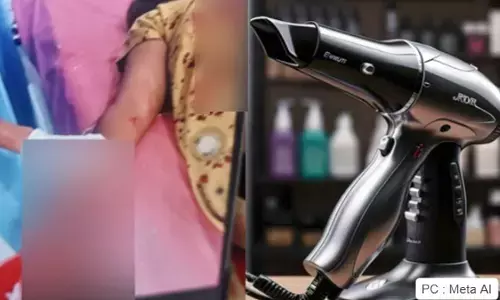 ಬಾಗಲಕೋಟೆ | ಹೇರ್ ಡ್ರೈಯರ್ ಸ್ಫೋಟ : ಮಹಿಳೆಗೆ ಗಂಭೀರ ಗಾಯ