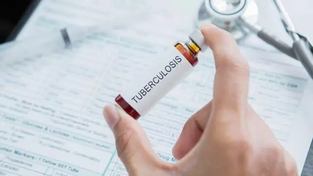 2040ರ ಹೊತ್ತಿಗೆ ಭಾರತದಲ್ಲಿ 6.2 ಕೋಟಿಗೂ ಹೆಚ್ಚು ಕ್ಷಯ ಪ್ರಕರಣಗಳು : ವರದಿ