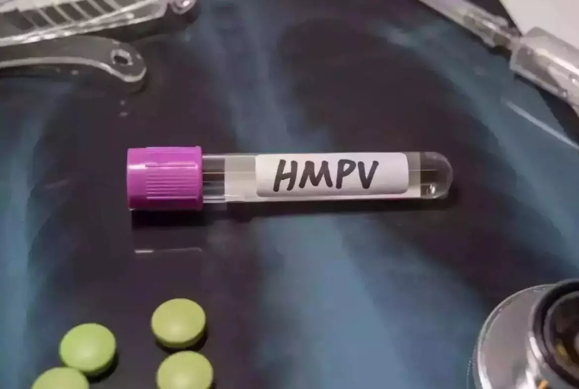 ಚೆನ್ನೈನಲ್ಲಿ ಇಬ್ಬರು ಮಕ್ಕಳಲ್ಲಿ HMPV ಪತ್ತೆ : ಭಾರತದಲ್ಲಿ ಸೋಂಕಿತರ ಸಂಖ್ಯೆ 5ಕ್ಕೆ ಏರಿಕೆ