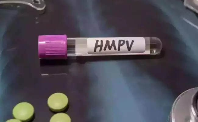 ಎಚ್ಎಂಪಿವಿ ಹರಡದಂತೆ ತಡೆಗಟ್ಟಲು ಮಾರ್ಗಸೂಚಿ ಪ್ರಕಟ ಎಚ್ಎಂಪಿವಿ ಹರಡದಂತೆ ತಡೆಗಟ್ಟಲು ಮಾರ್ಗಸೂಚಿ ಪ್ರಕಟ