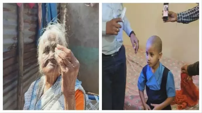 ಮಹಾರಾಷ್ಟ್ರ | ಮೂರು ಹಳ್ಳಿಗಳ ಜನರಲ್ಲಿ ಕಾಣಿಸಿಕೊಂಡ ಹಠಾತ್ ಕೂದಲು ಉದುರುವಿಕೆ!